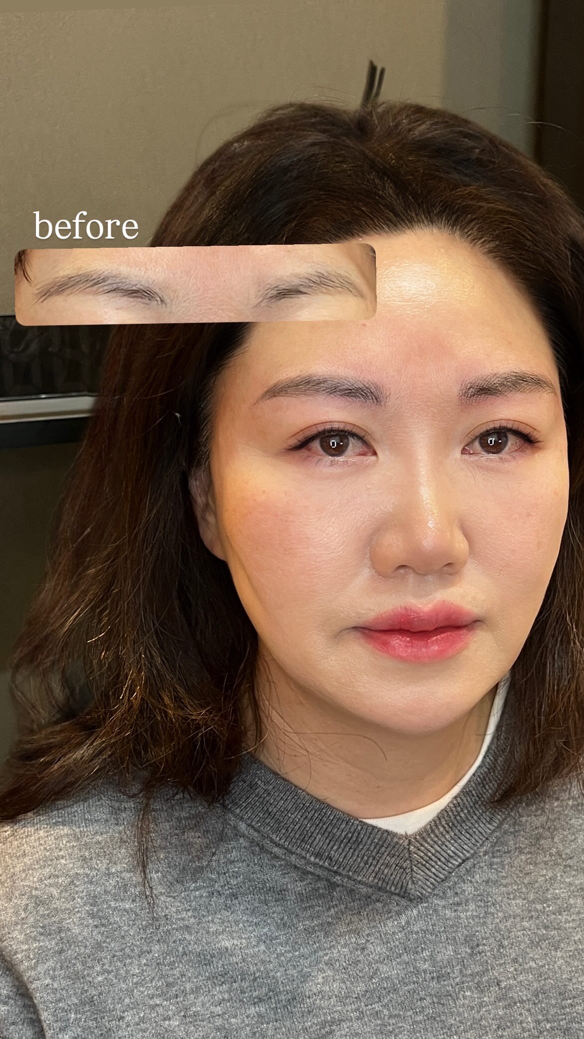 눈썹 시술 사진 1