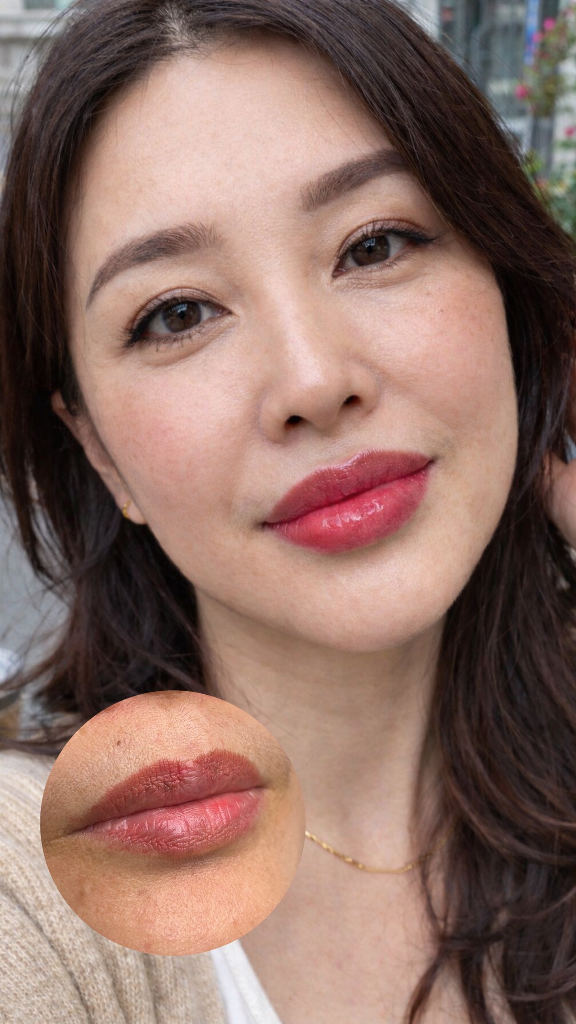 입술 시술 사진 5